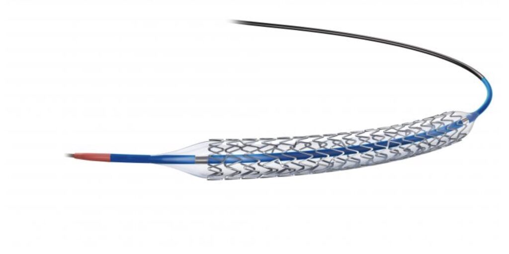 “Τοποθέτηση stent κατά τη διάρκεια αγγειοπλαστικής – επεμβατικός καρδιολόγος Θεσσαλονίκη”